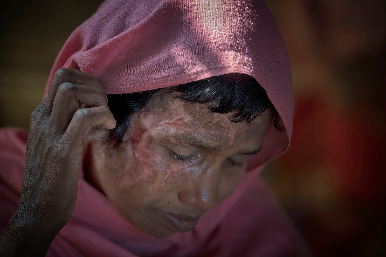 Rohingya Victim by Stephen Wallace